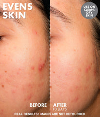 Yo Glow AHA & BHA Facial Enzyme Scrub